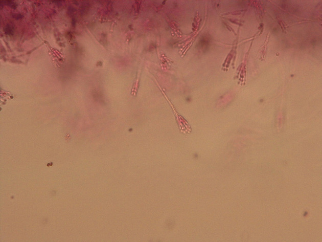 Penicillium Slides - Penicillium 04 400X